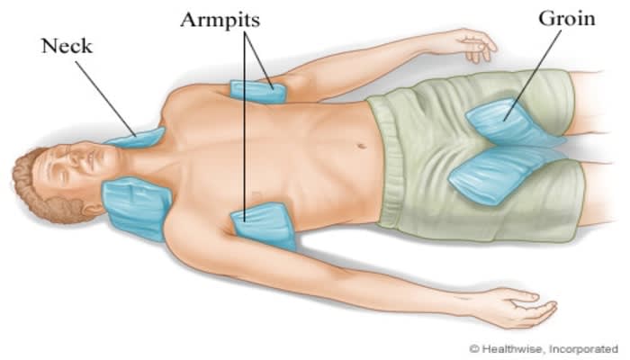 28_Dec_2017_154329493_First_Aid_Information_for_Heatstroke 28_Dec_2017_154329493_First_Aid_Information_for_Heatstroke