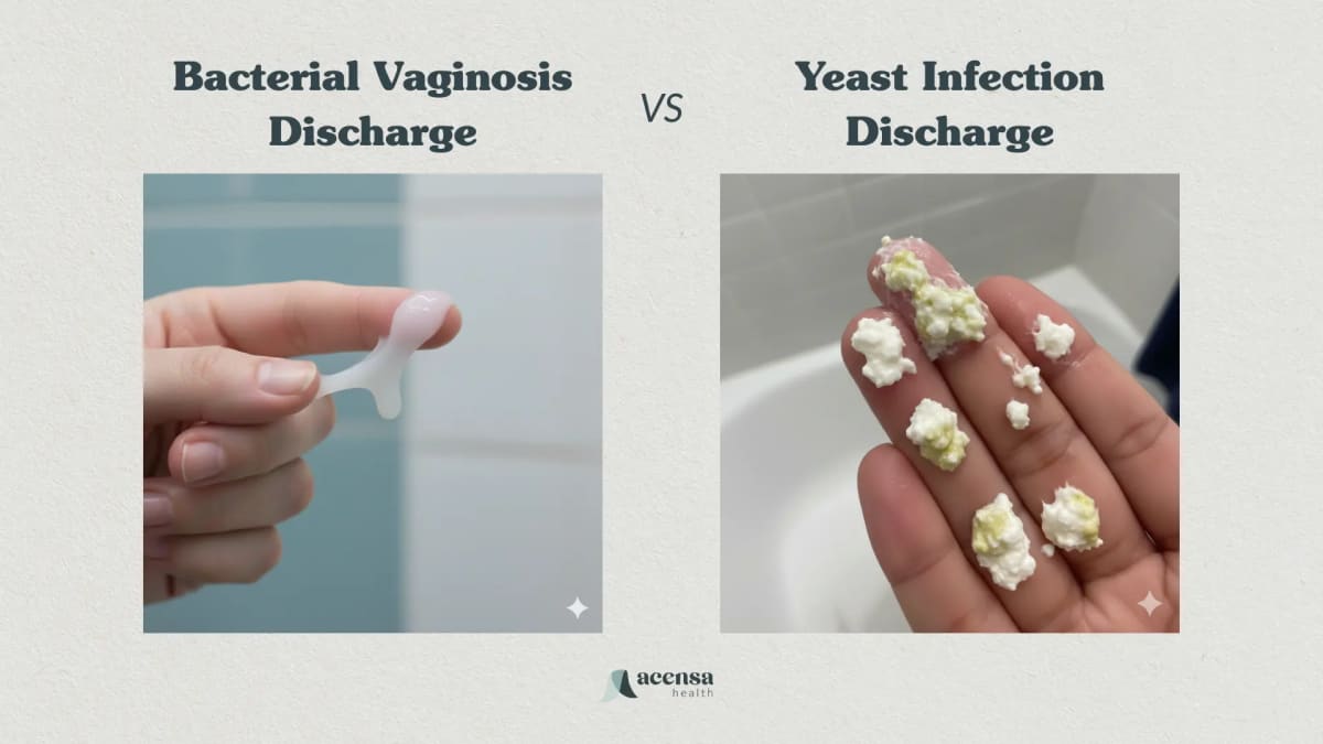 Bacterial-Vaginosis-Discharge-vs-yeat-infection-discharge Bacterial-Vaginosis-Discharge-vs-yeat-infection-discharge