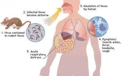 Hantavirus (1)