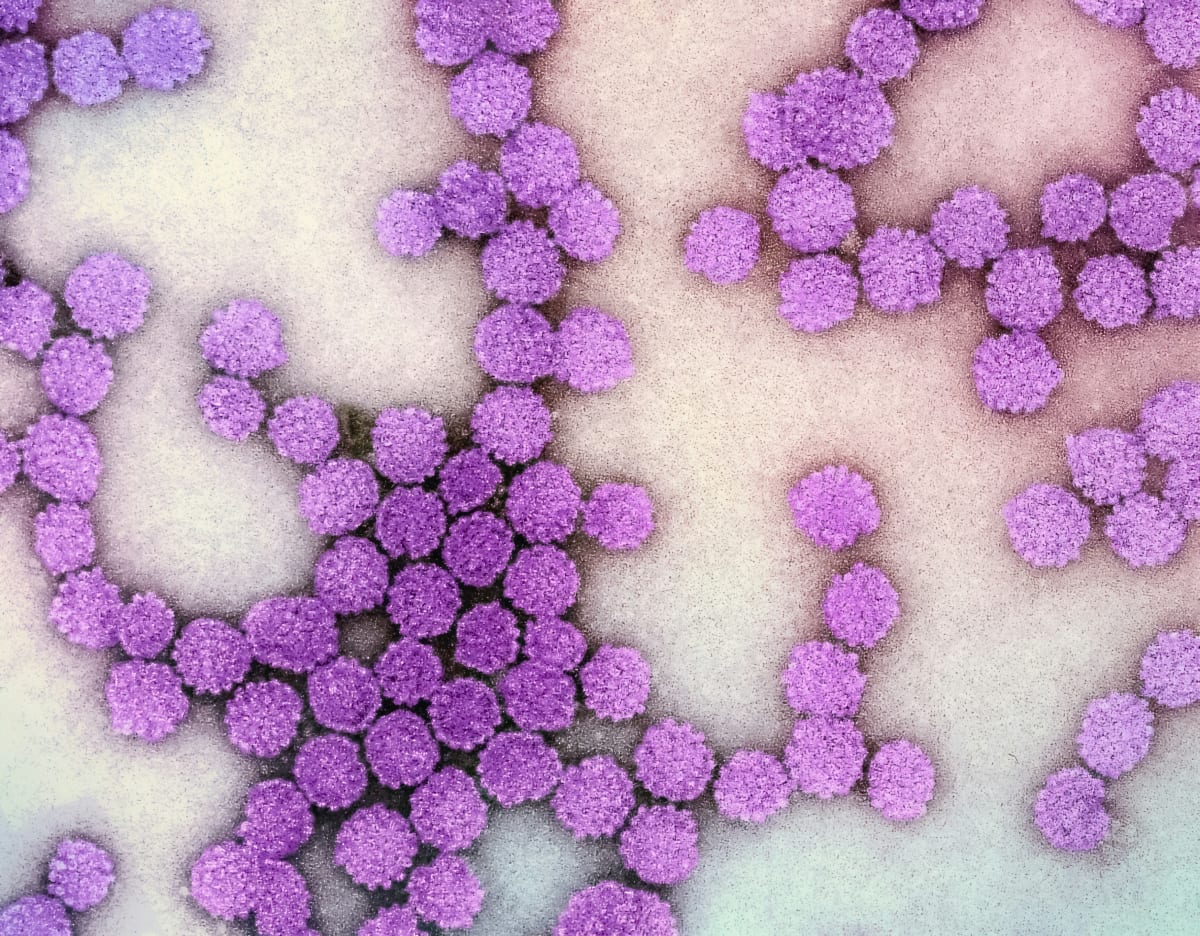 national-institute-of-allergy-and-infectious-diseases-WCN8lfZX4ZI-unsplash national-institute-of-allergy-and-infectious-diseases-WCN8lfZX4ZI-unsplash