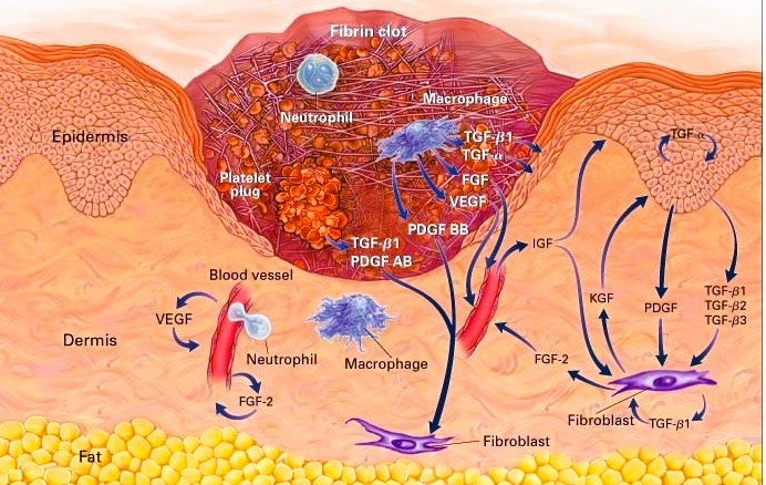 Cardiovascular Disease