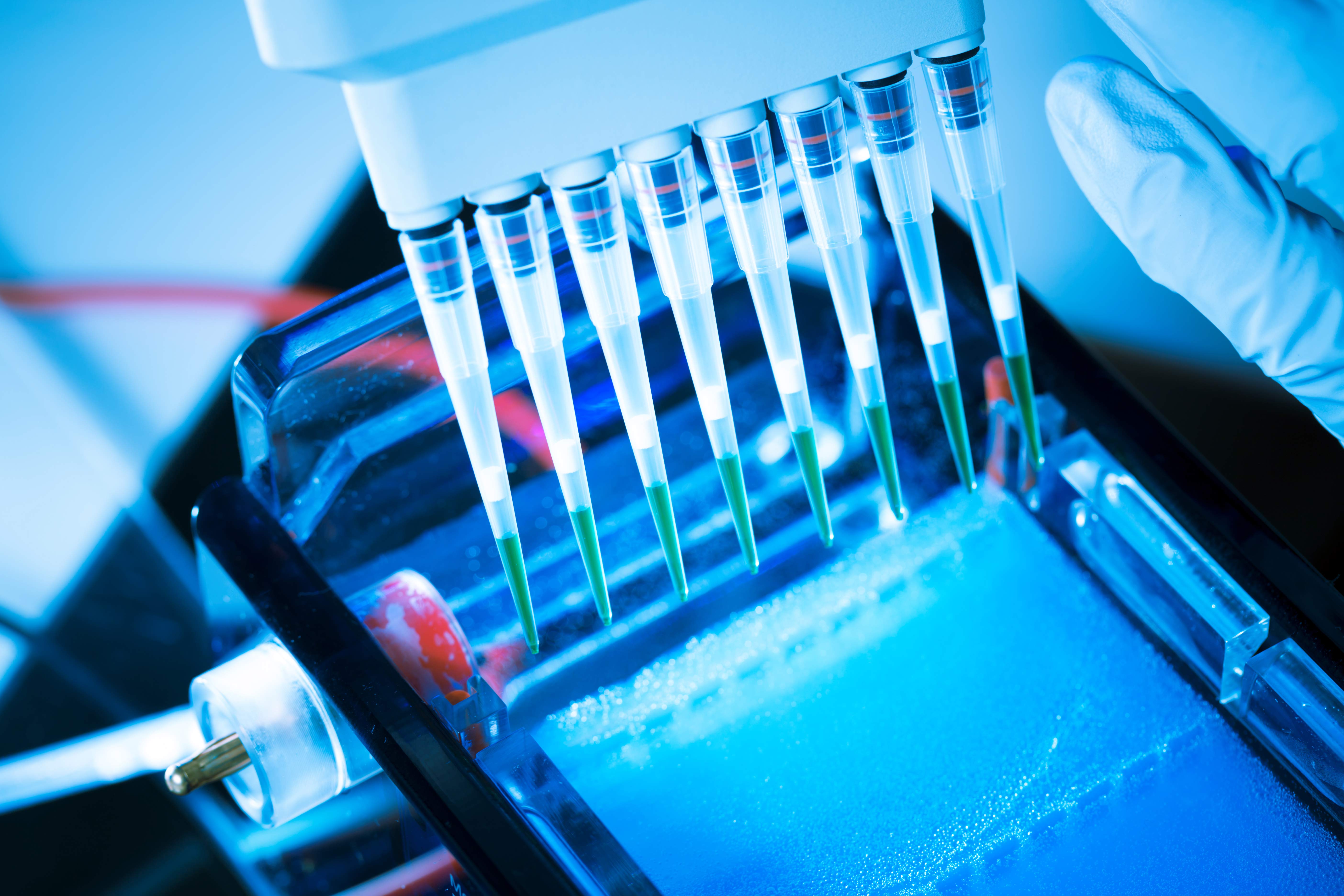 Cardiovascular Disease