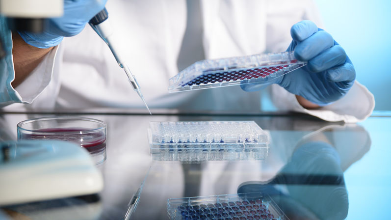 Cardiovascular Disease