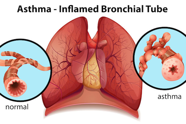 an illustration showing the difference between healthy and unhealthy lungs