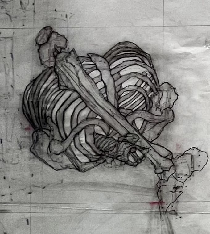 Bone Ballet