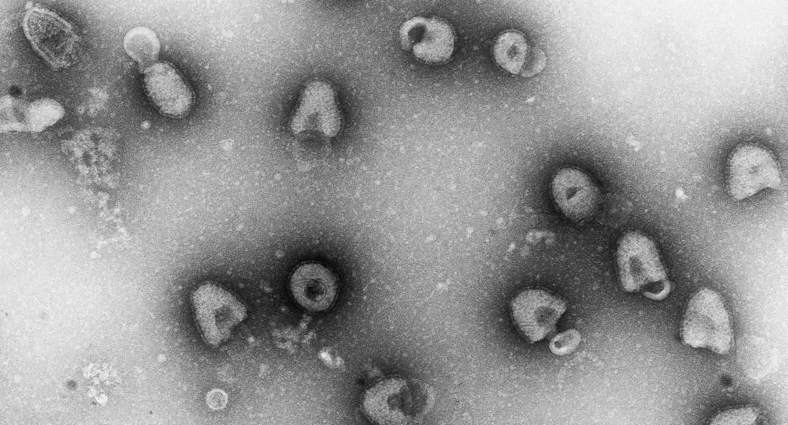 Viruses under the microscope