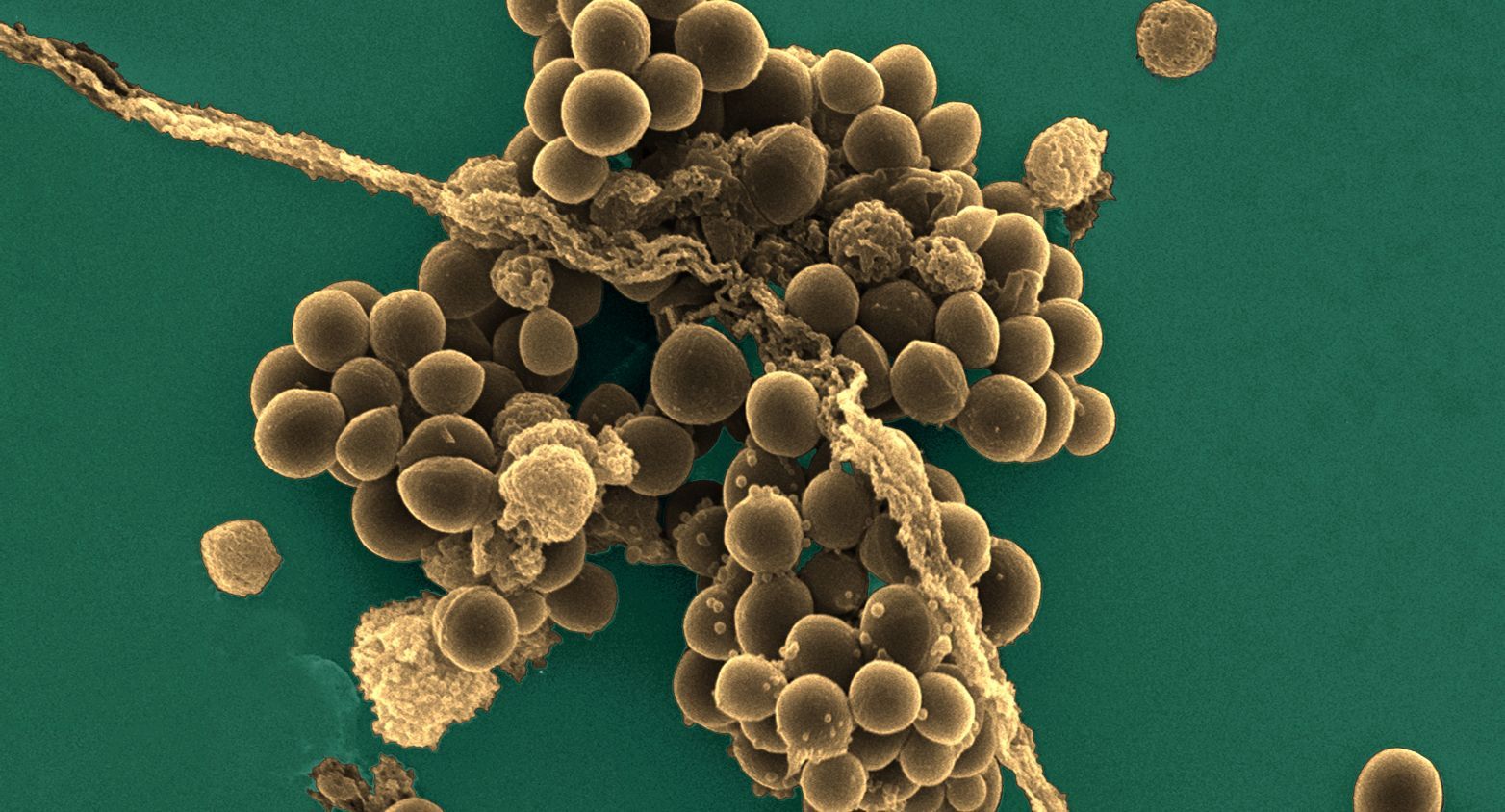 Staph bacteria under microscope 2