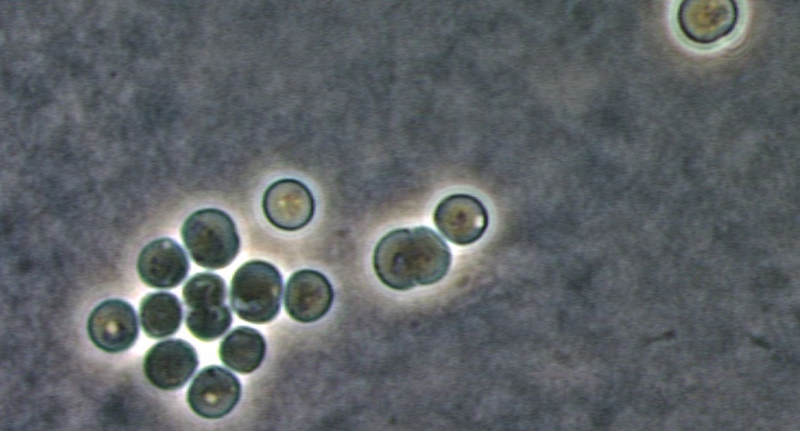 Synechocystis cyanobacteria under microscope
