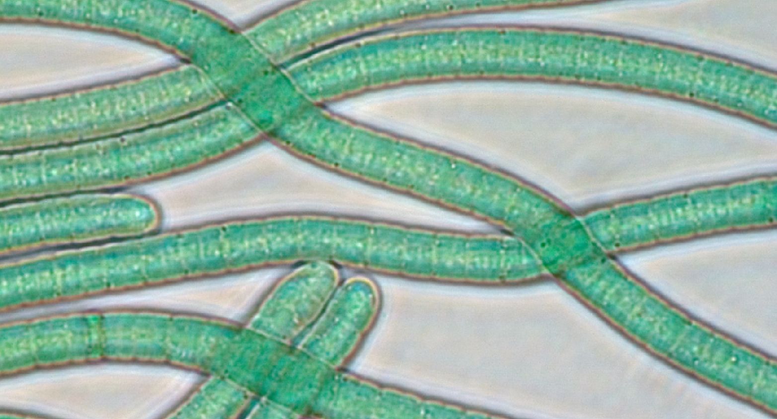 Planktothrix paucivesiculata cyanobaccteria under microscope