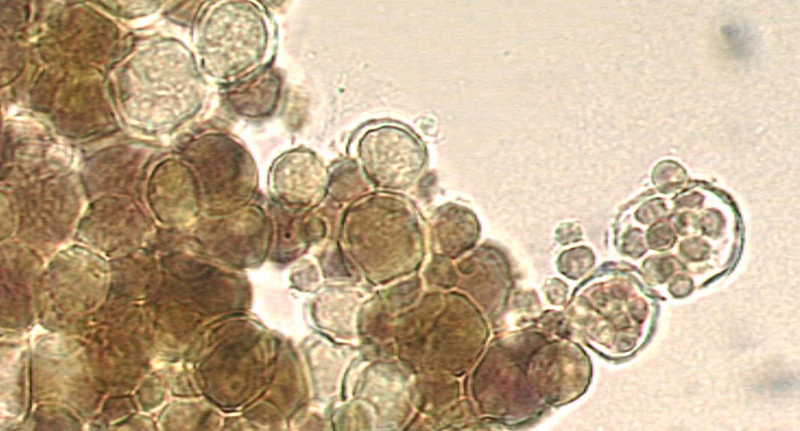 Stanieria cyanobacteria under microscope