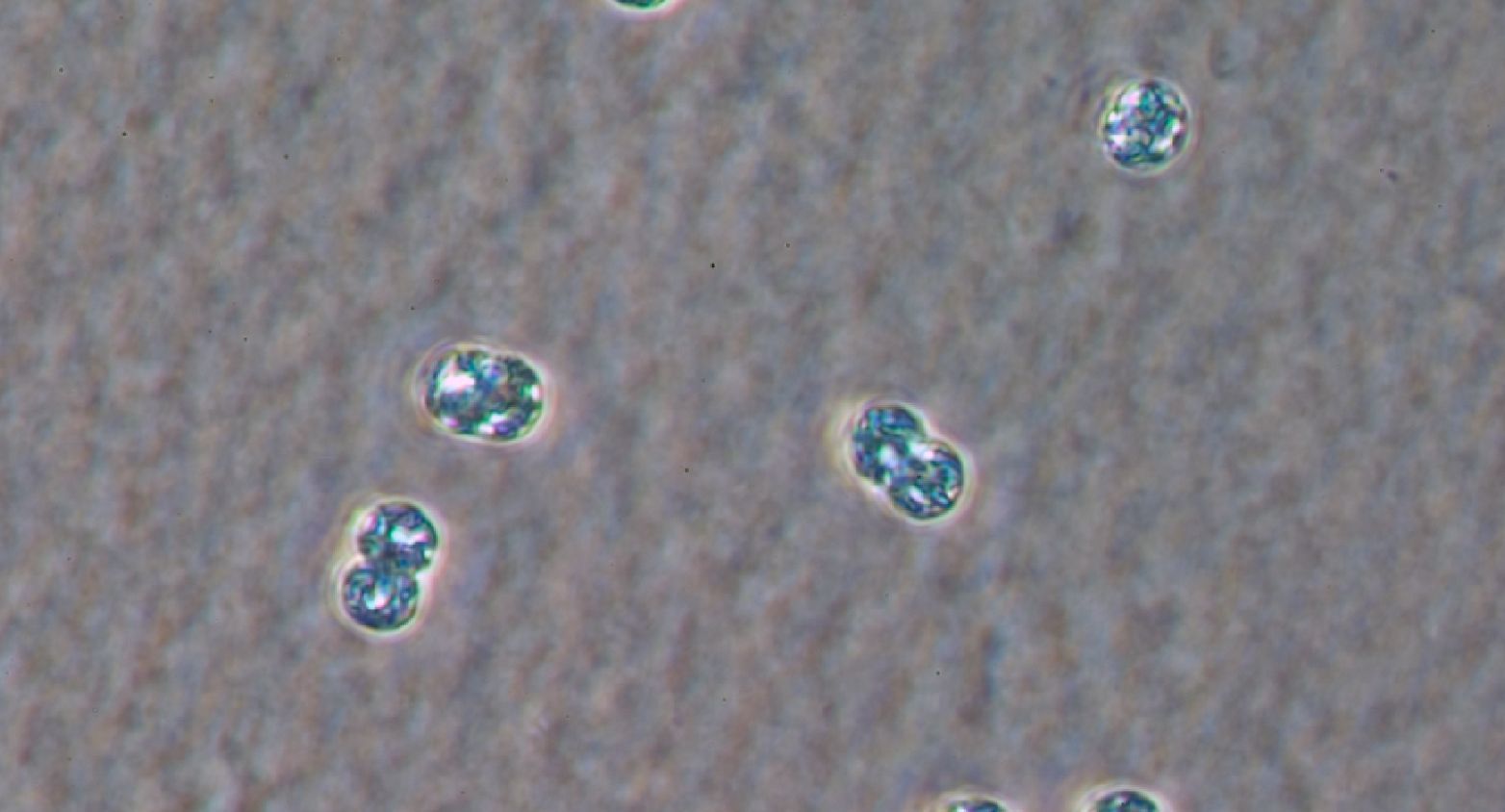 The cyanobacteria Microcystis aeruginosa under microscope
