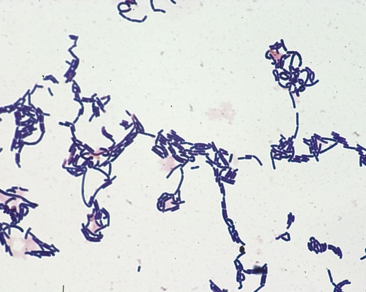 Bacteria under microscope