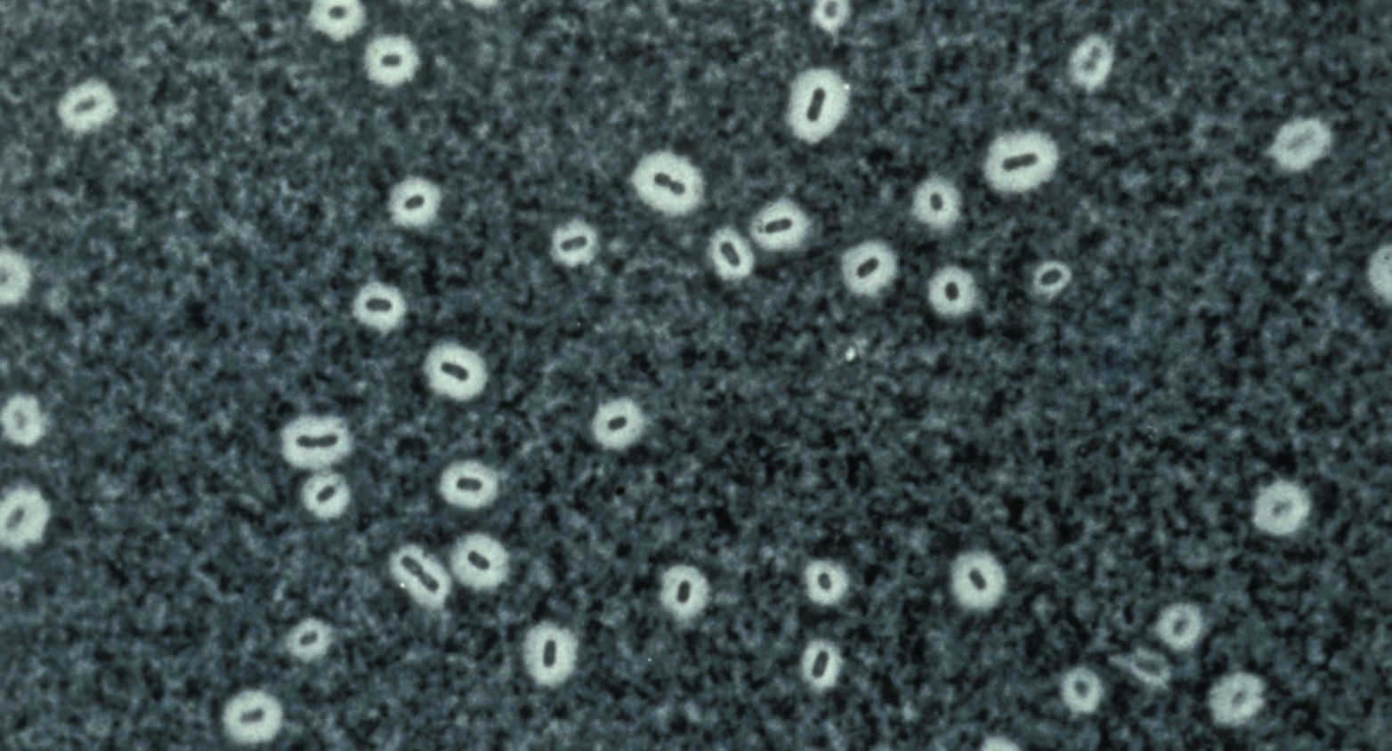 Klebsiella bacteria under microscope 2