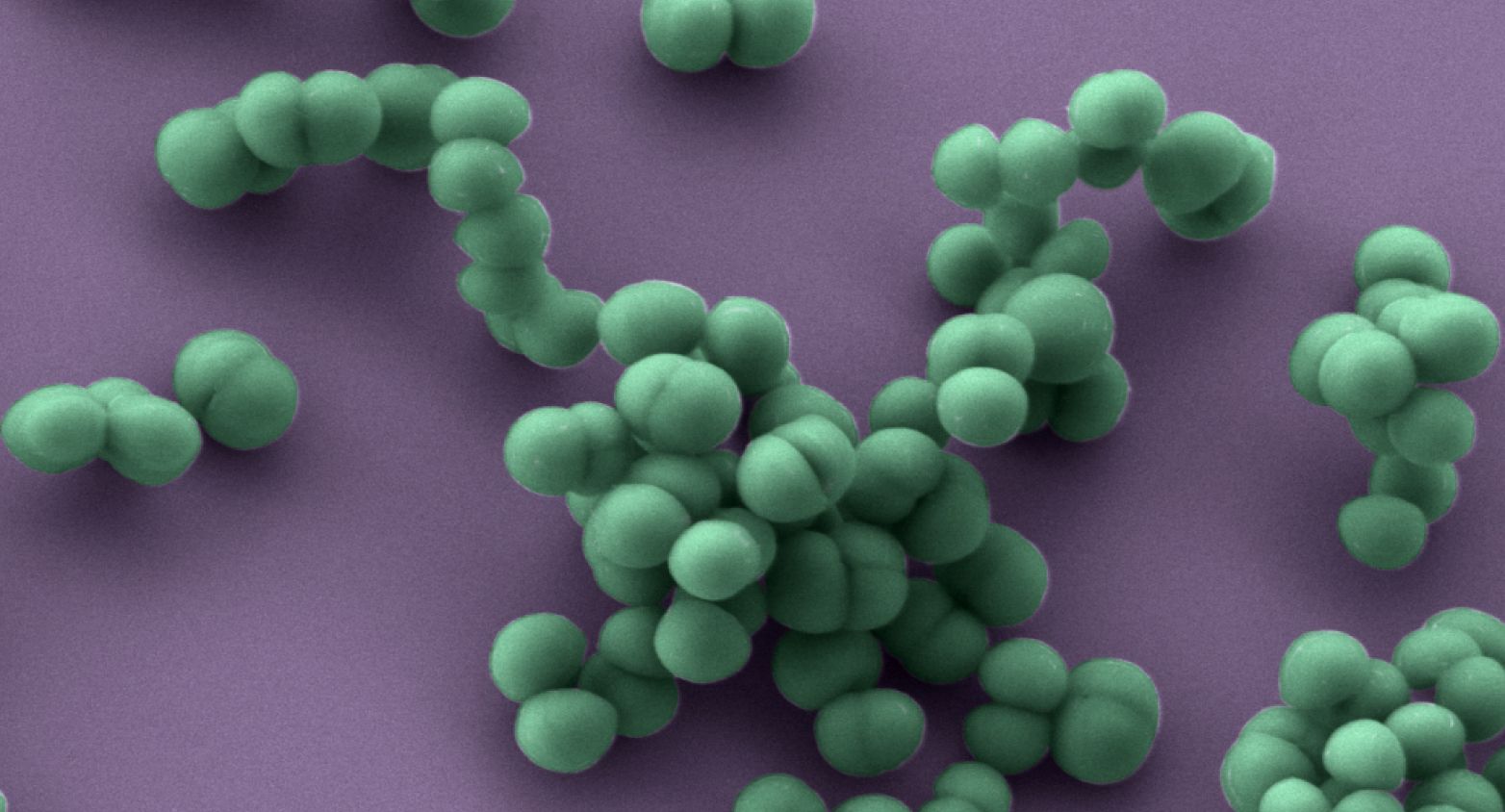 Staphylococcus aureus bacteria under microscope