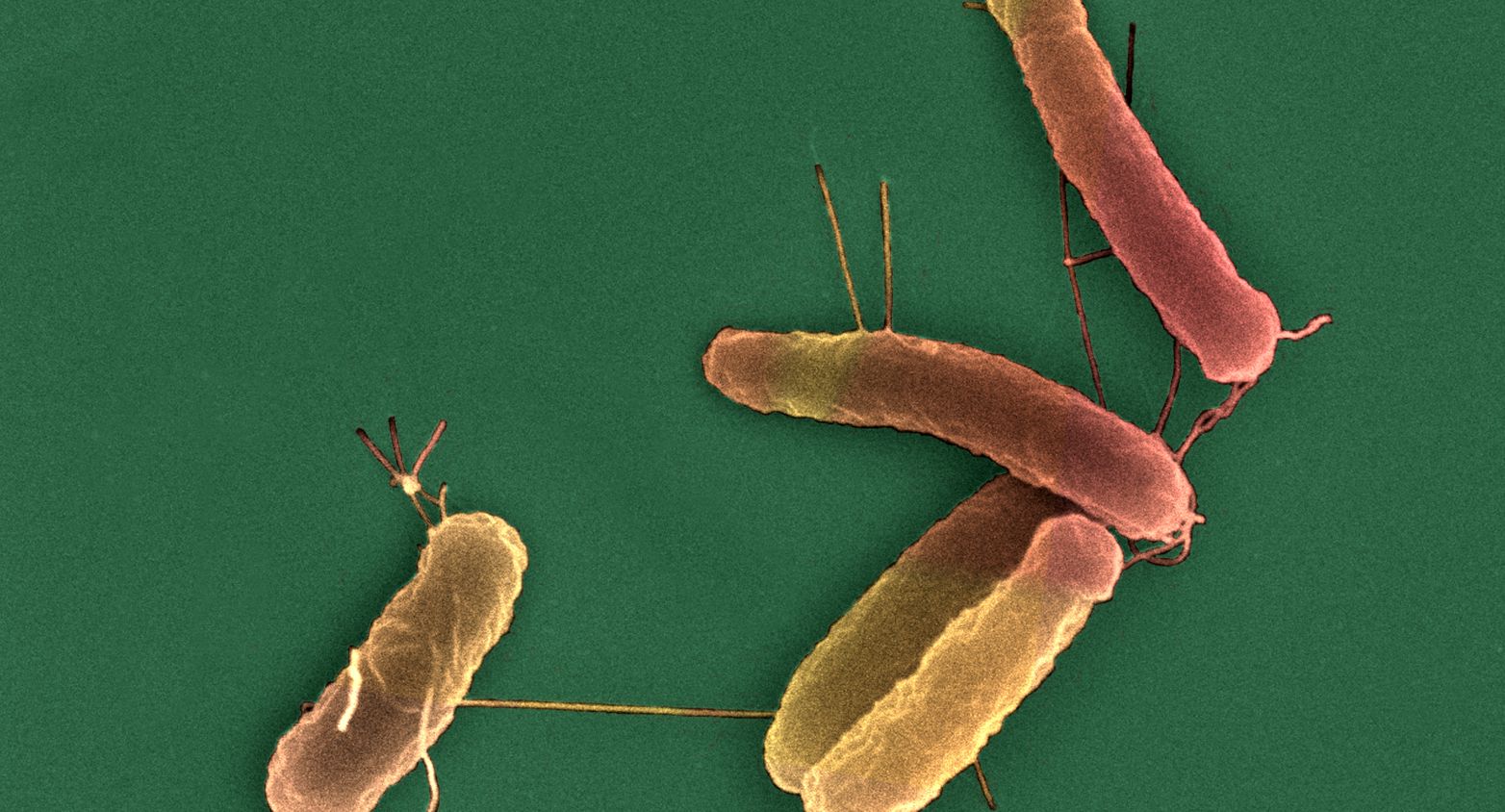 Escherichia coli strains under microscope