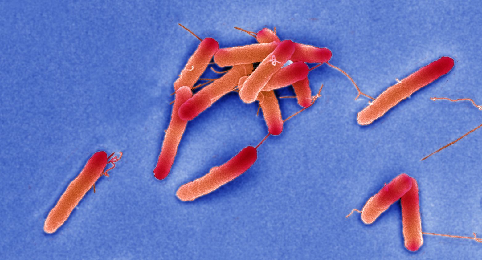 Escherichia coli K-12 strains under microscope