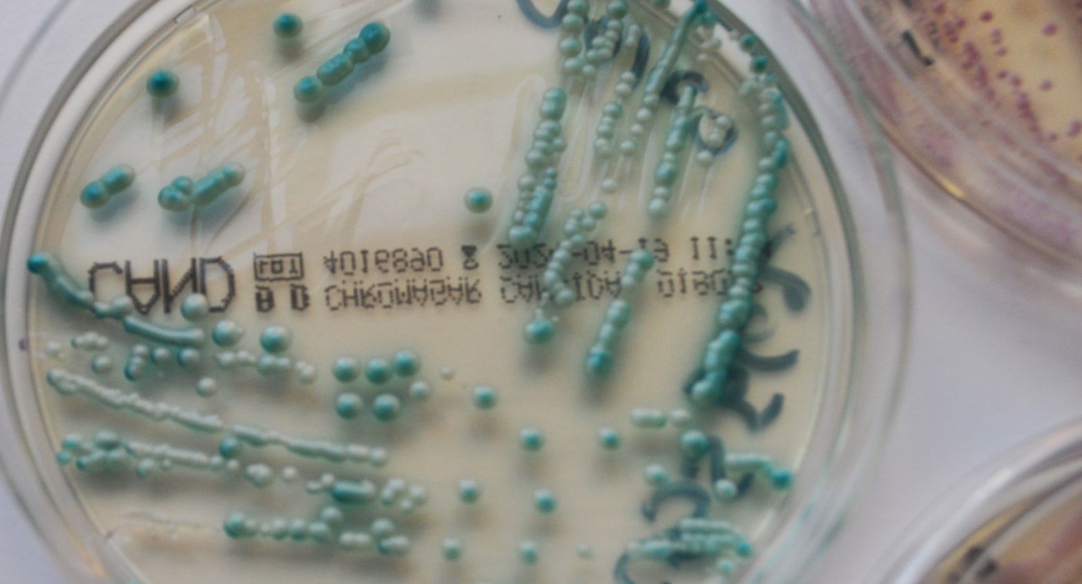 Yeast in a Petri dish