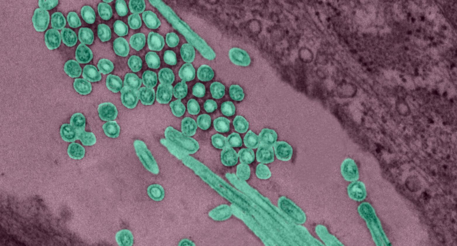 Influenza virus under microscope