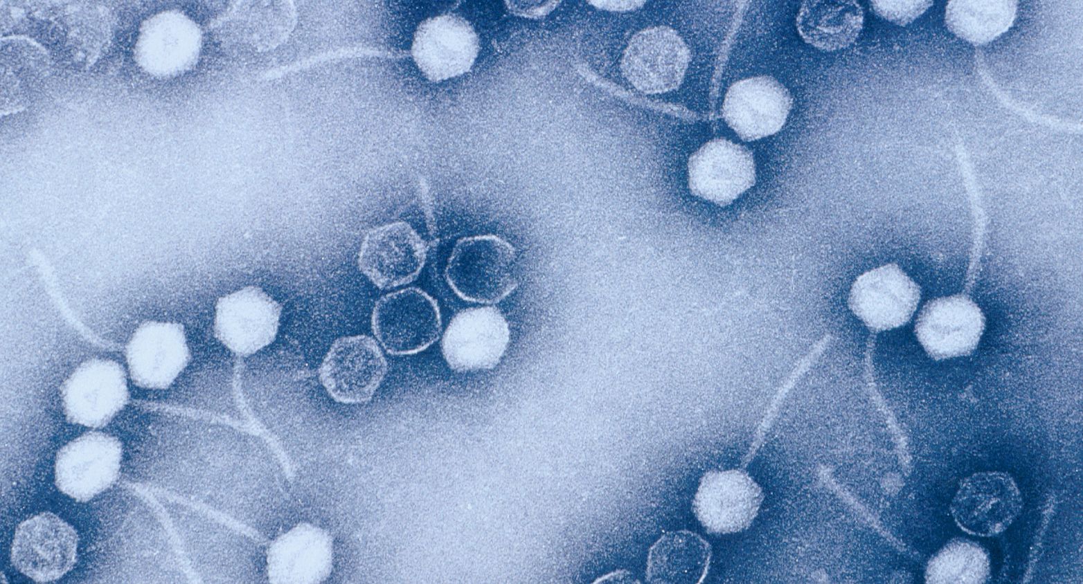 Bacteriophages under microscope