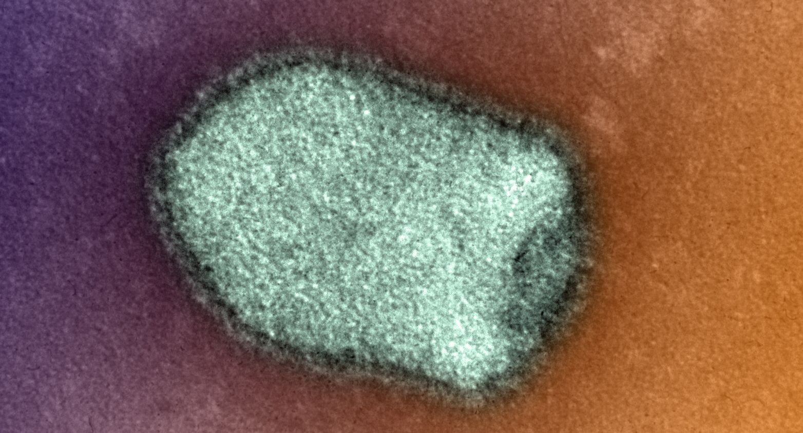 Lissyavirus under microscope