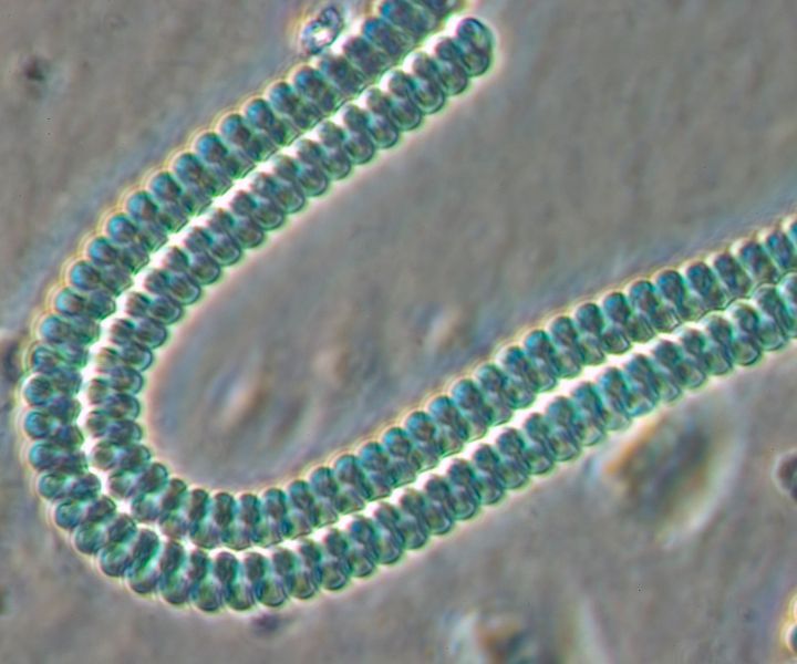 Cyanobacteria under microscope 2