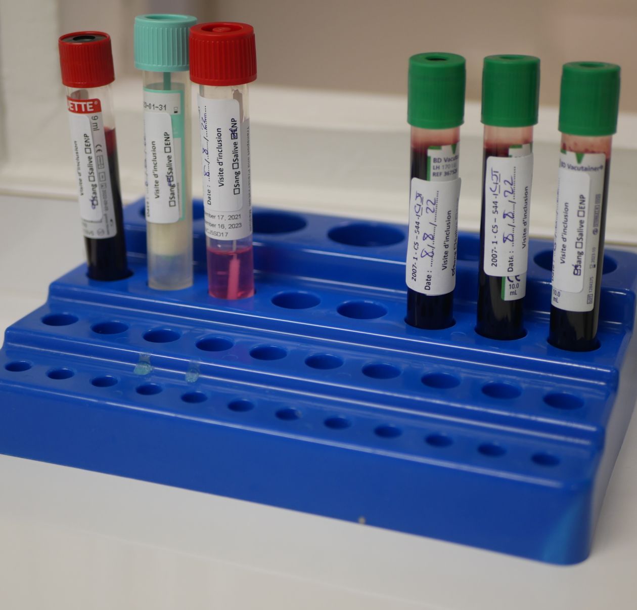 Several human samples in tubes