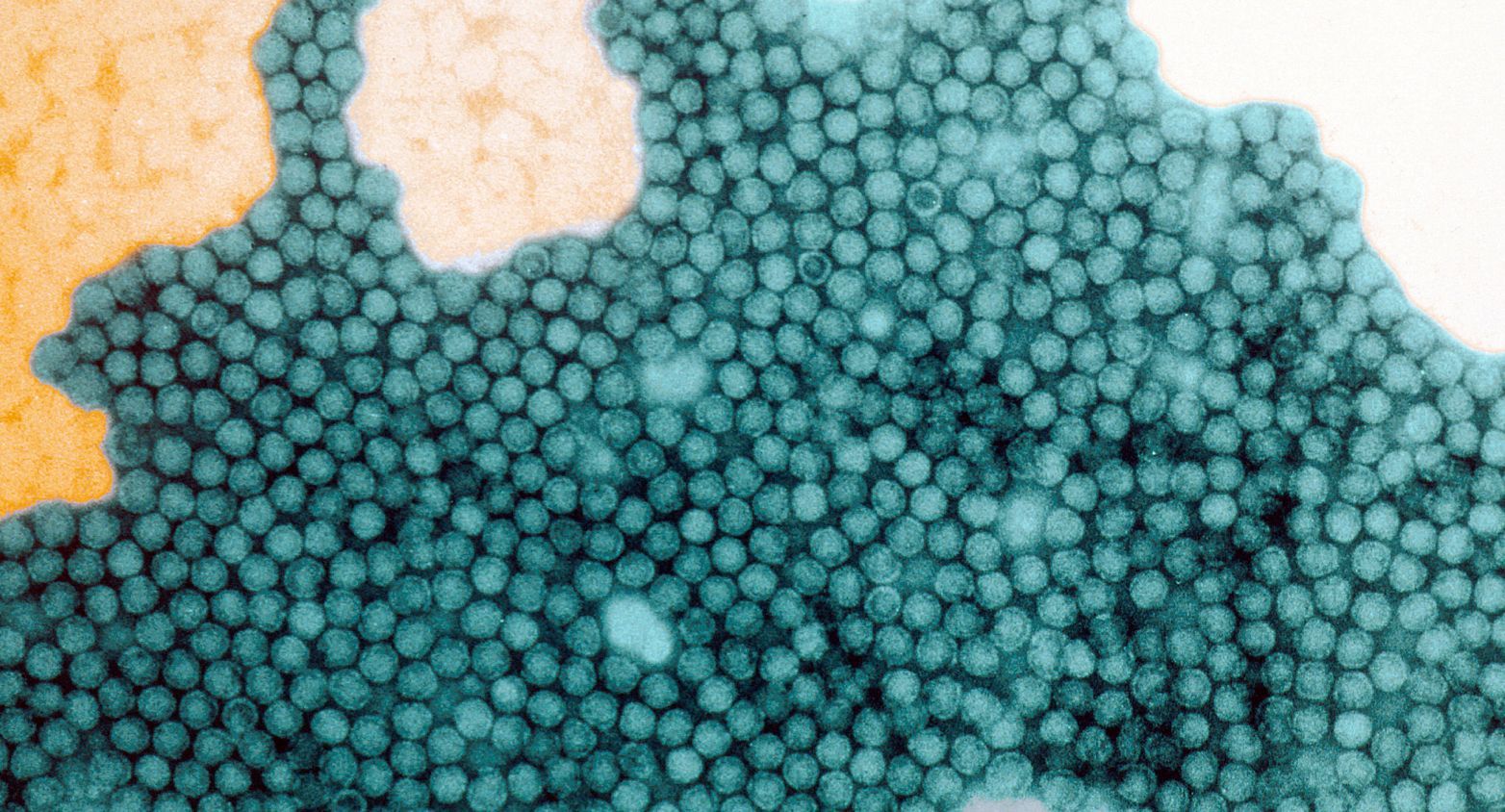 Poliovirus under microscope