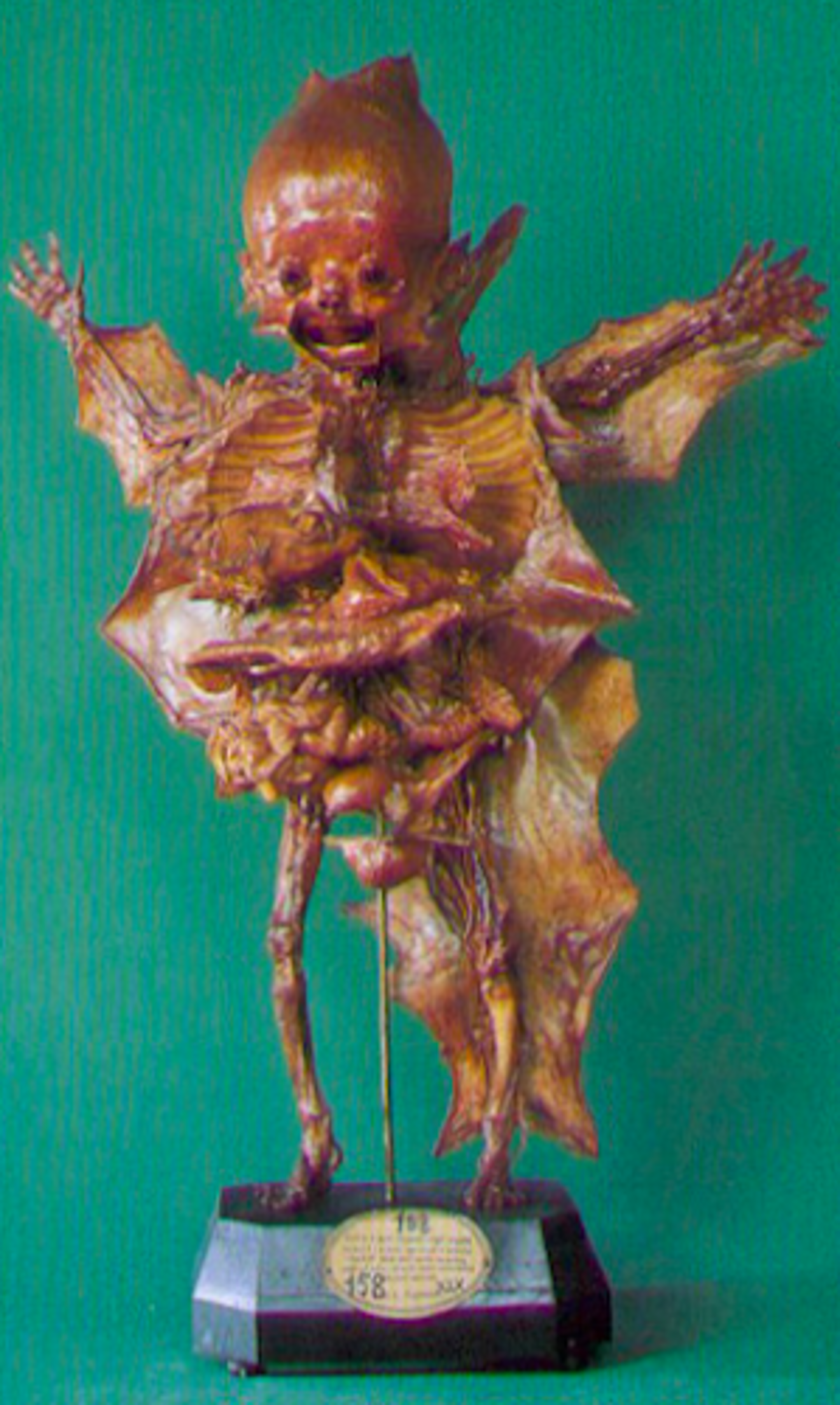 University of Florence - Museum of Pathological Anatomy