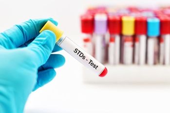 std treatment in Delhi