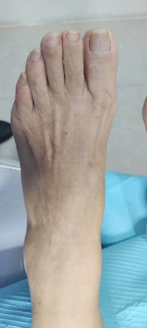 Pies Descalzos - Consultorio de Podología en Las Américas