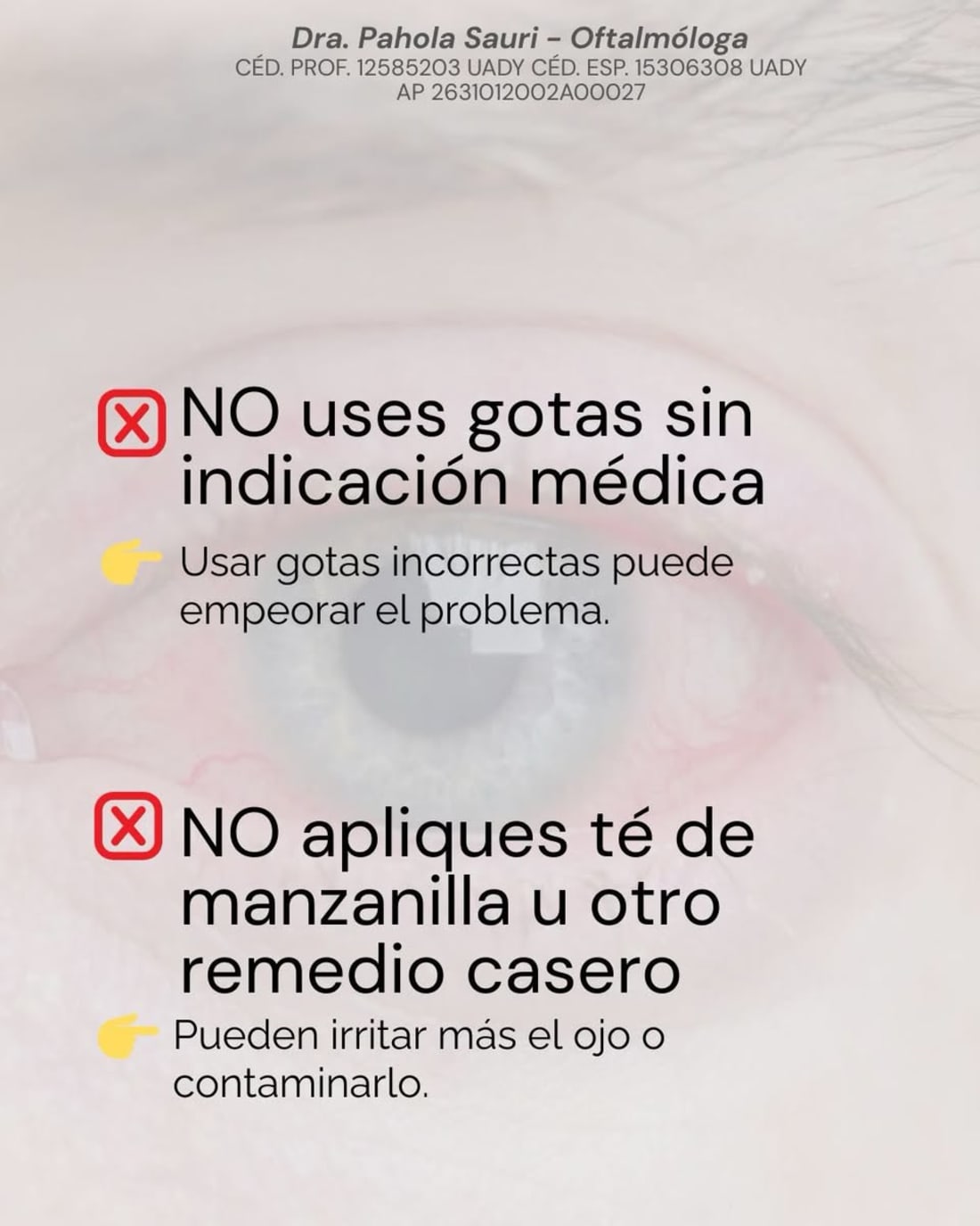 Foto 1 de 4, Imagen de Atención Médica para Conjuntivitis