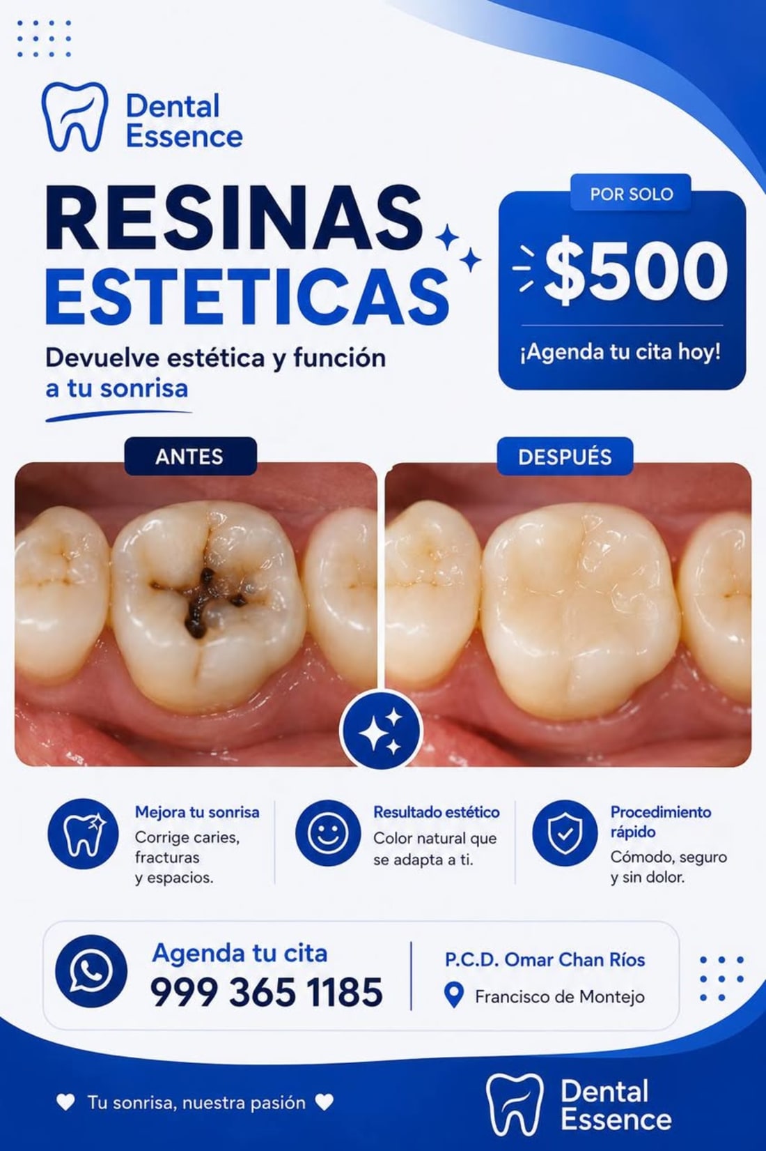 Dental Essence Diagnóstico Limpieza
