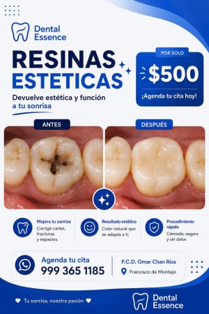 Dental Essence Diagnóstico Limpieza