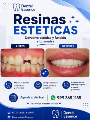 Dental Essence Diagnóstico Limpieza