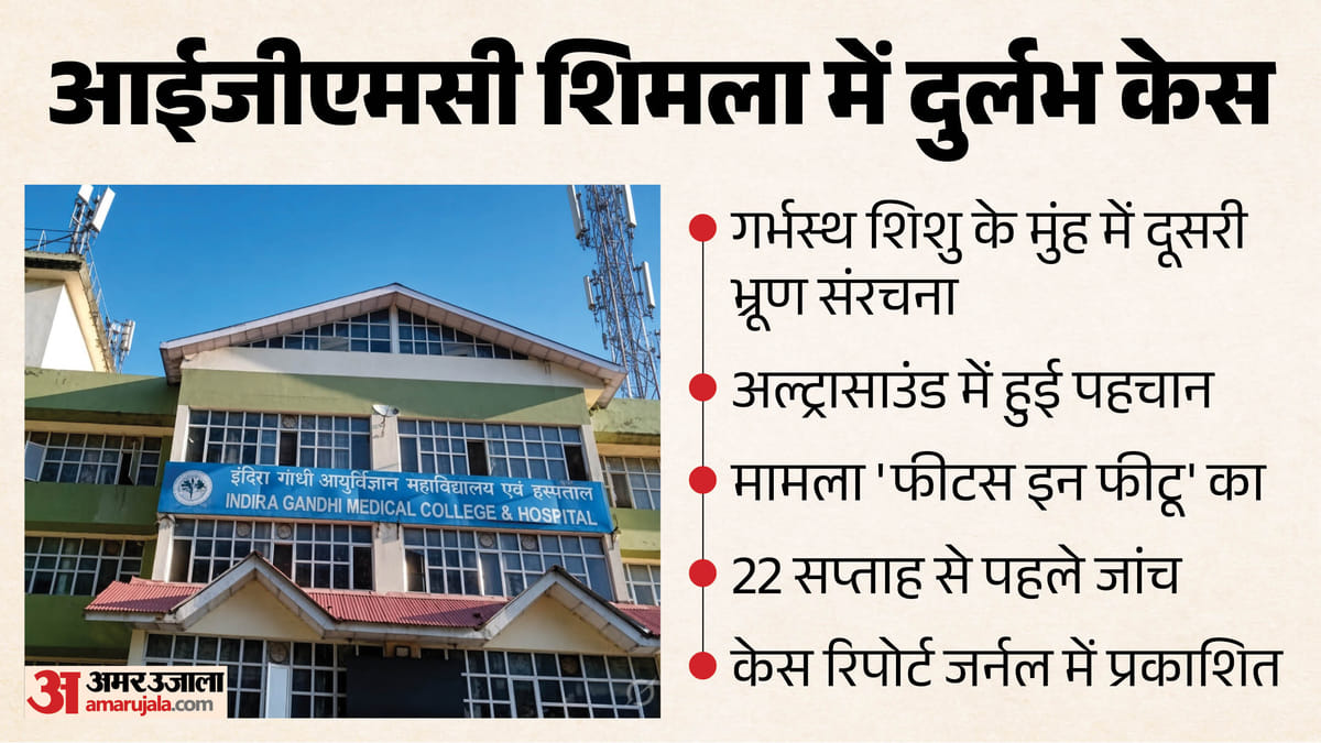 आईजीएमसी शिमला में दुर्लभ 'फीटस इन फीटस' (Fetus in Fetu) मामला: चिकित्सा विज्ञान की अनूठी चुनौती
