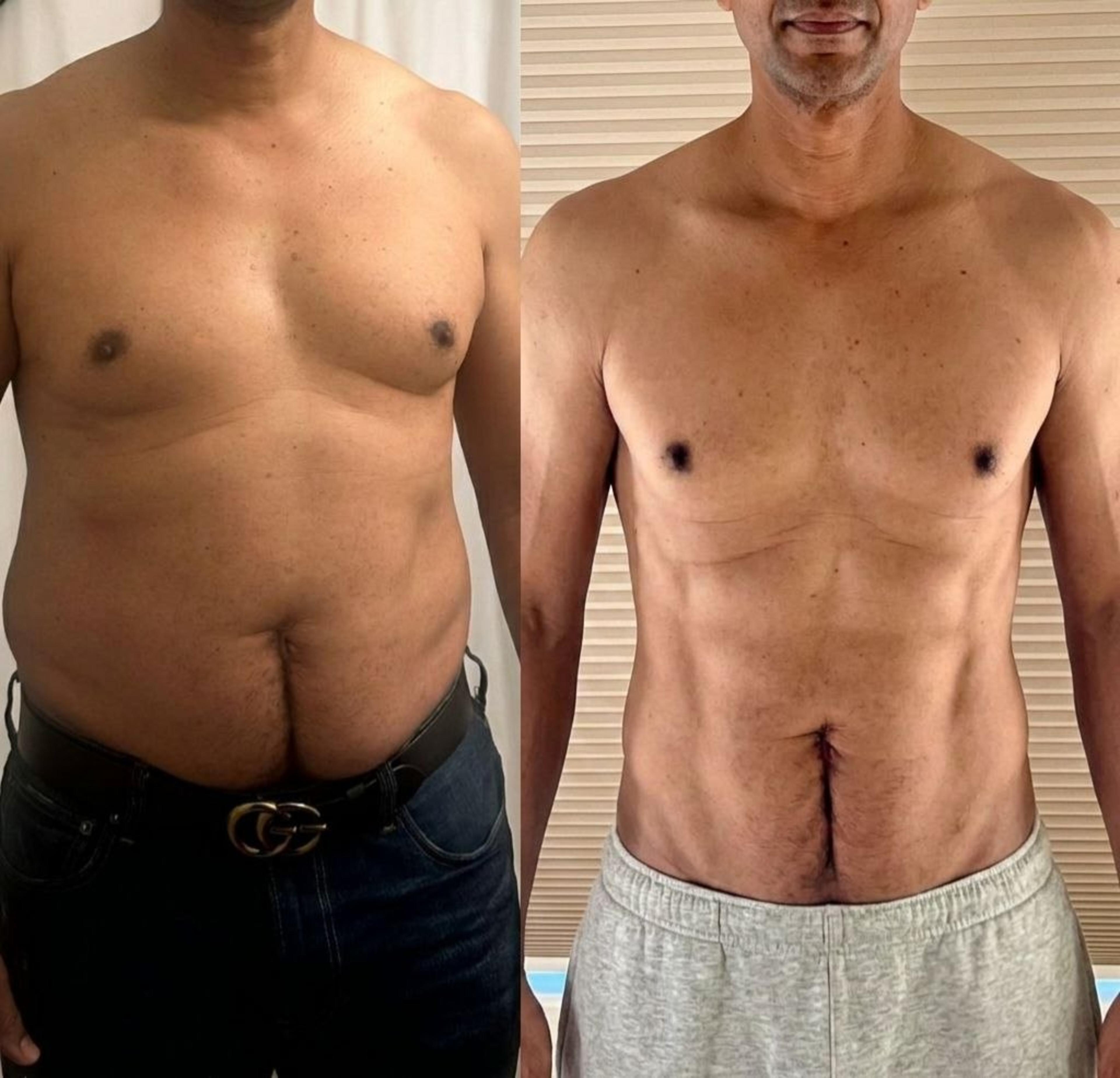 Transformation