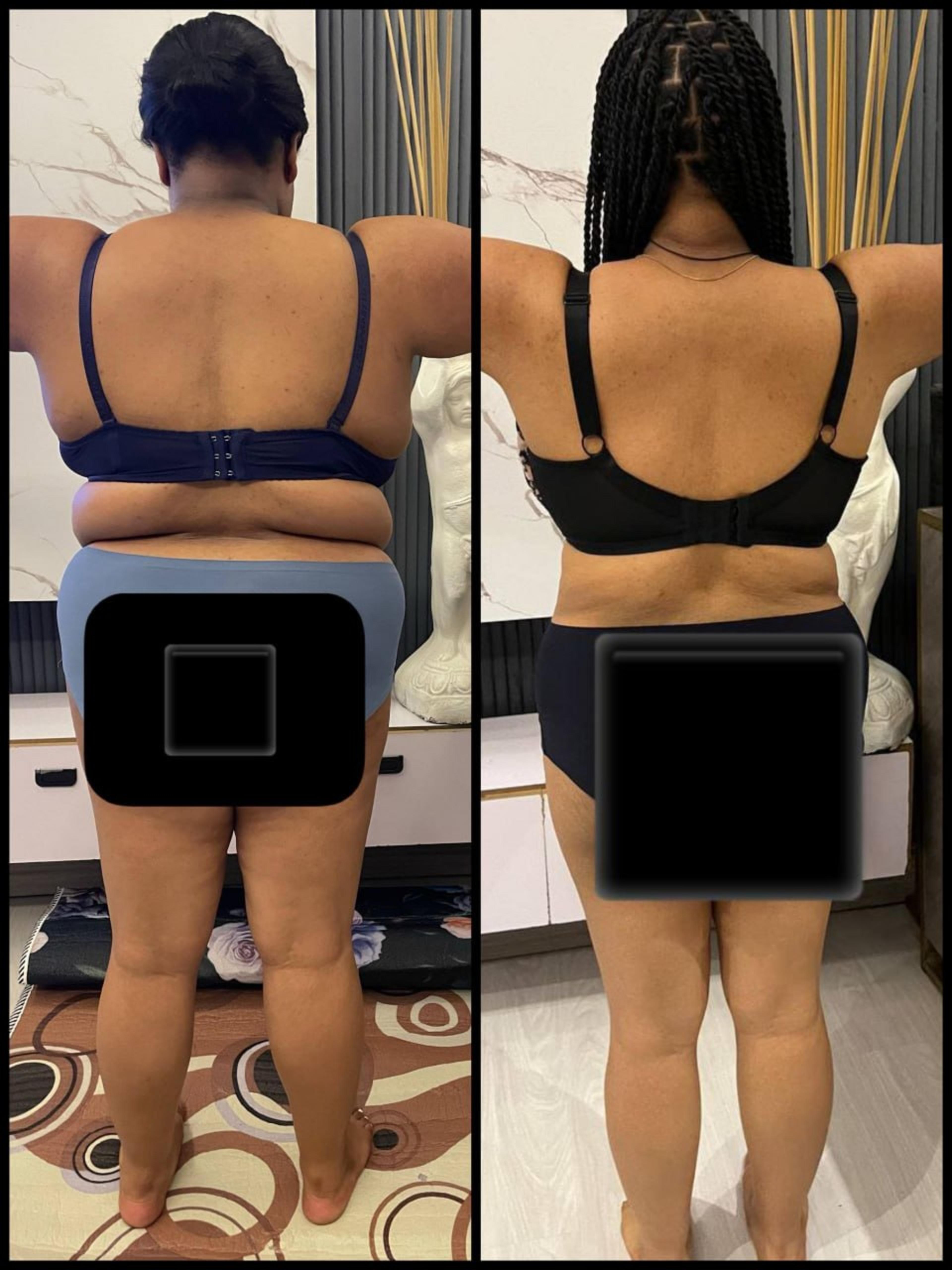 Transformation