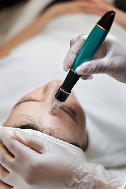 Face Microneedling