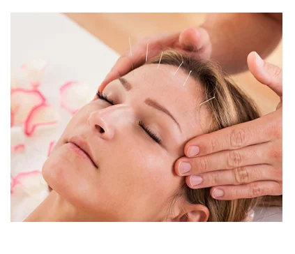 Introduction to Acupuncture