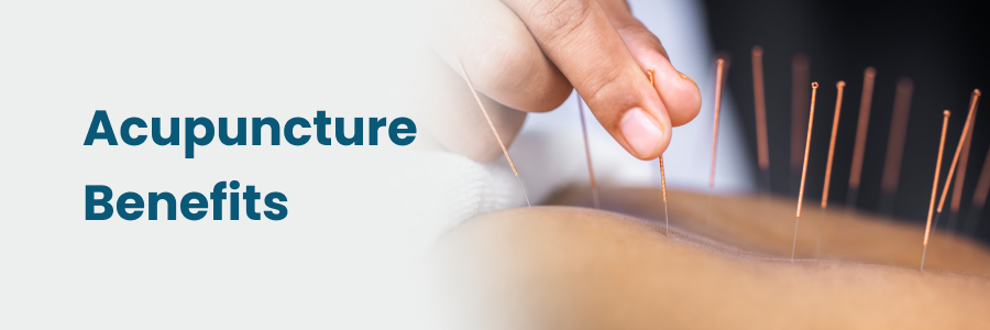 The Benefits of Acupuncture for Pain Management