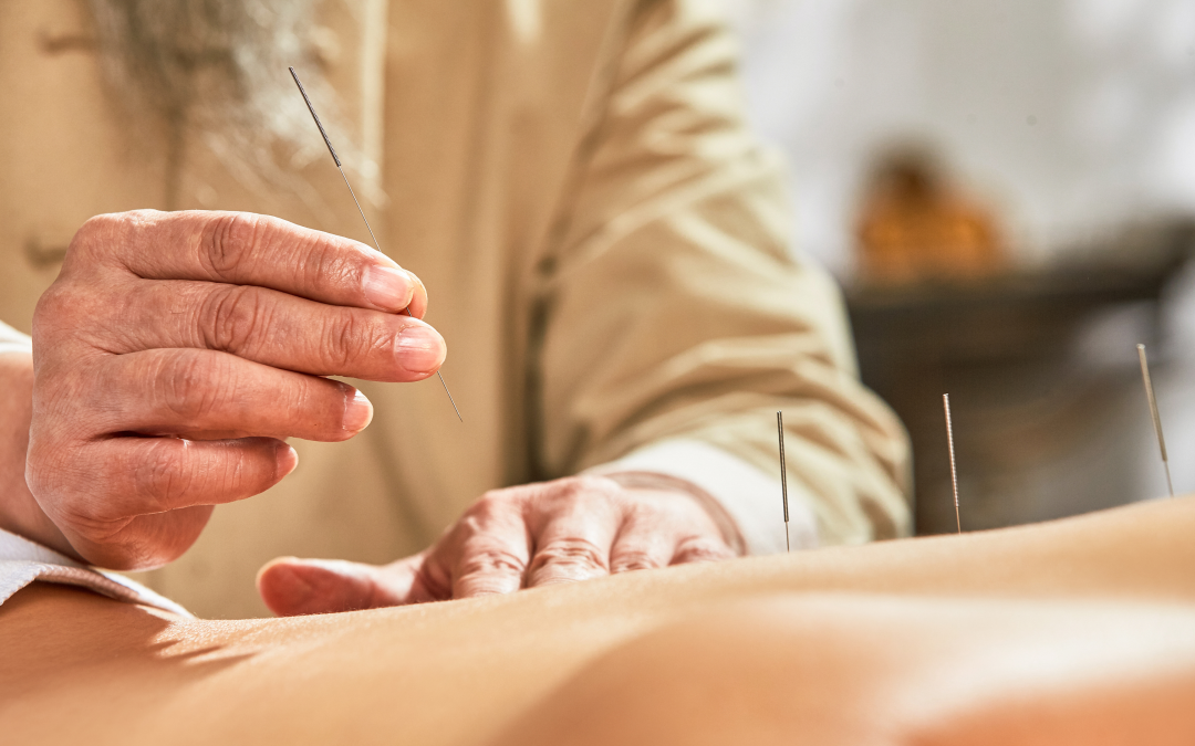 What to Expect During an Acupuncture Session