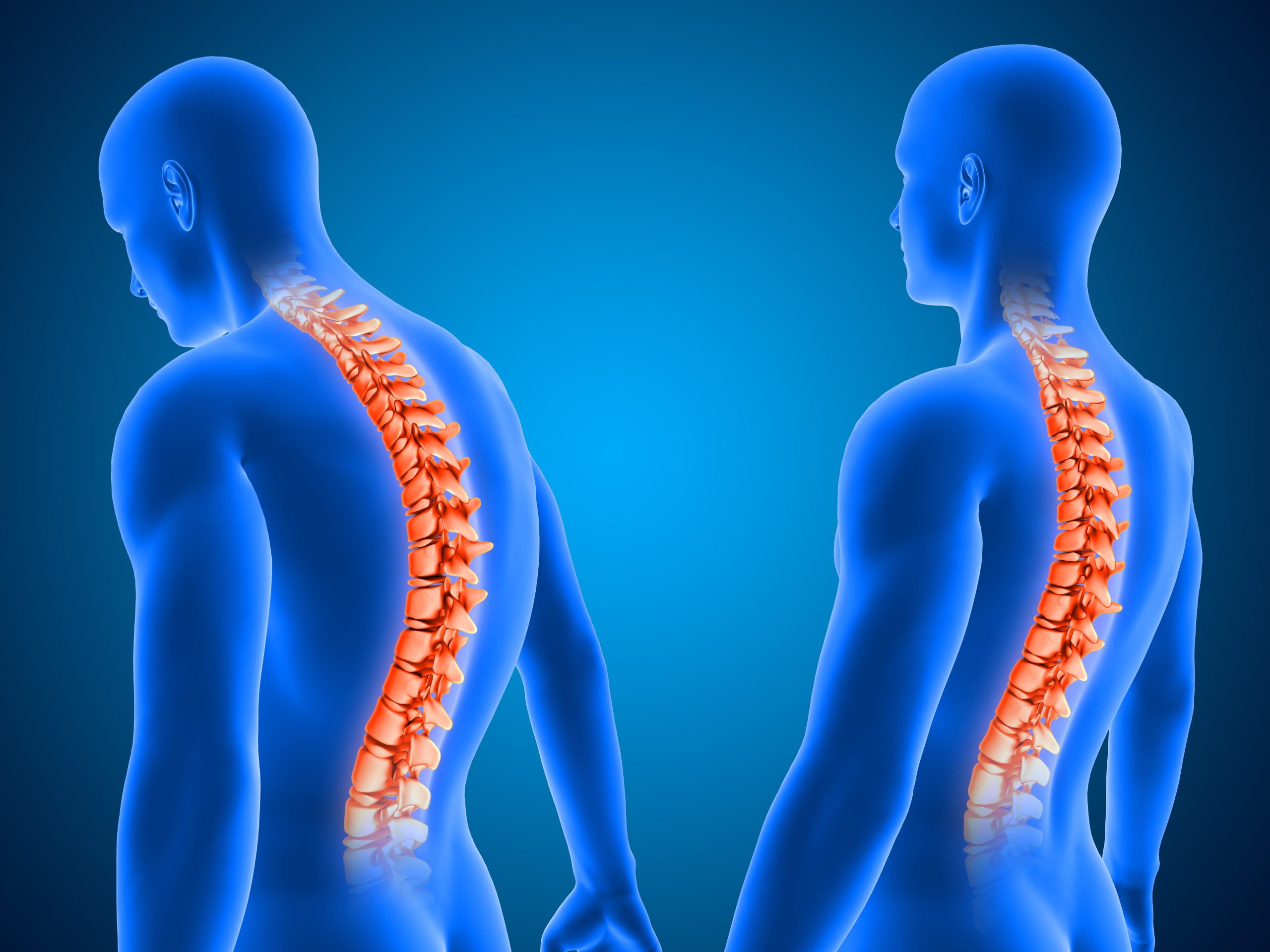 Improving Posture Through Chiropractic Adjustments