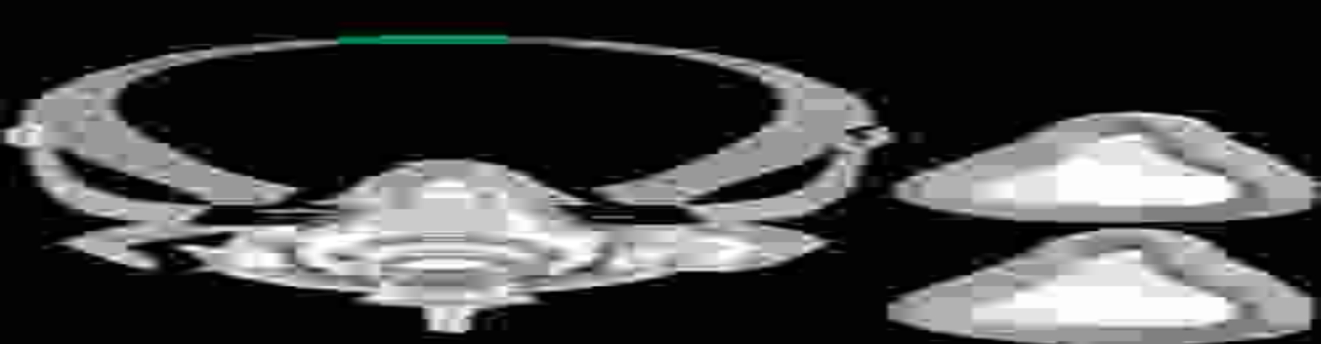 Auto CPAP banner