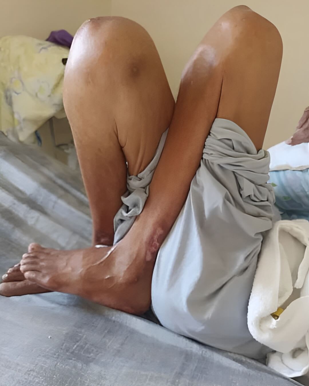 Quais são os gastos com uma pessoa acamada em Ponta Grossa - Paraná
