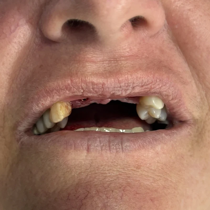 Imagem clínica inicial — caso 1
