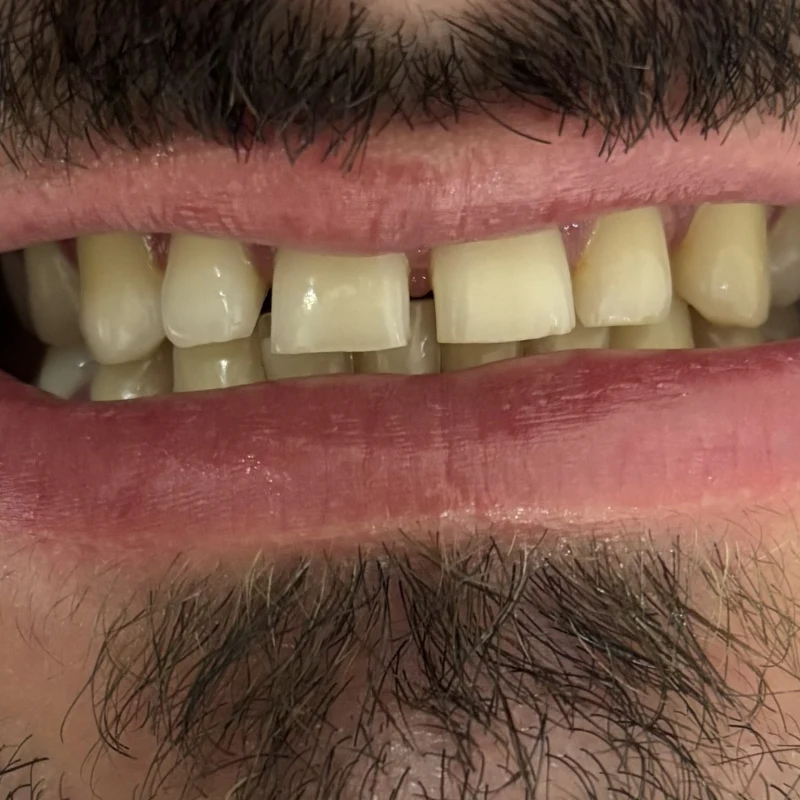Imagem clínica inicial — caso 3