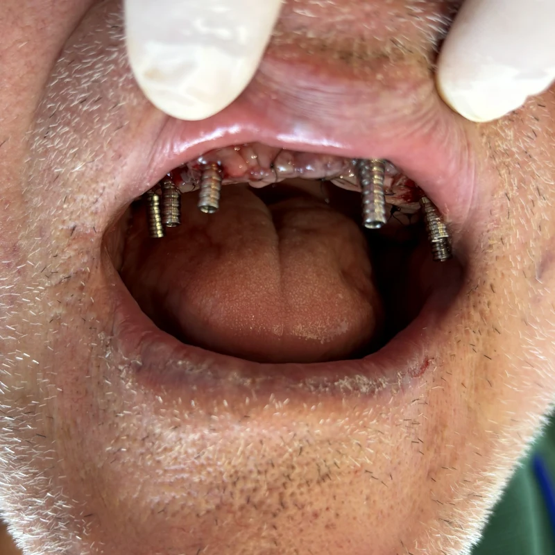 Imagem clínica inicial — caso 4