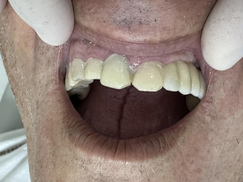 Imagem clínica inicial — caso 6