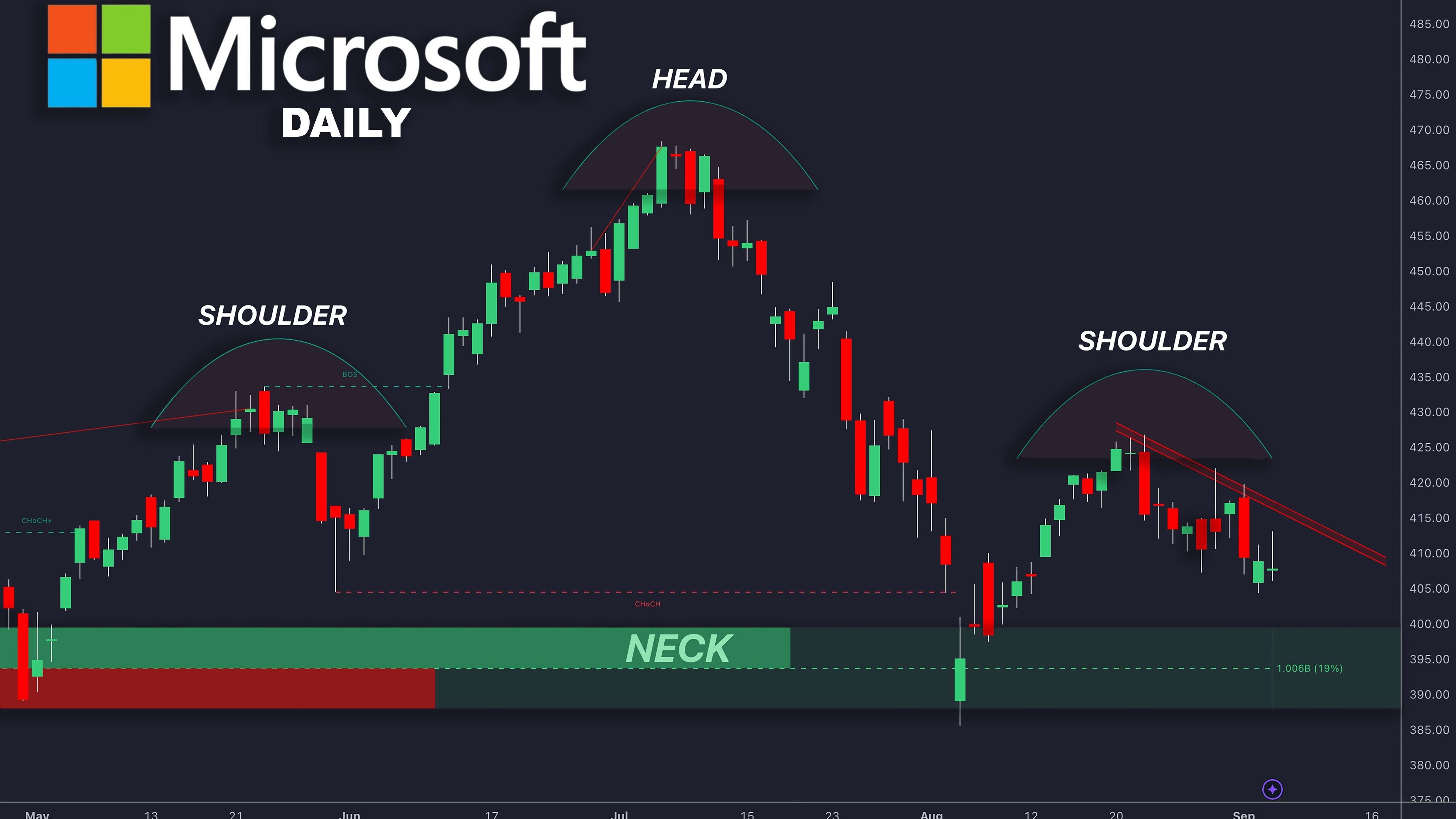 Head and Shoulders Pattern
