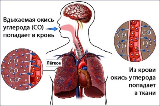 13 объясните физиологическое действие угарного газа на организм человека используя рисунок